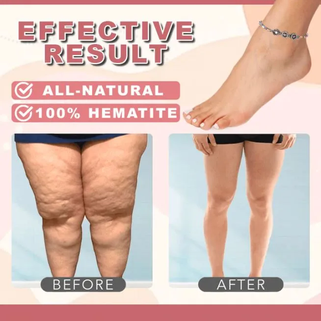 IONFIT™ Magnetic Slimming Anklet